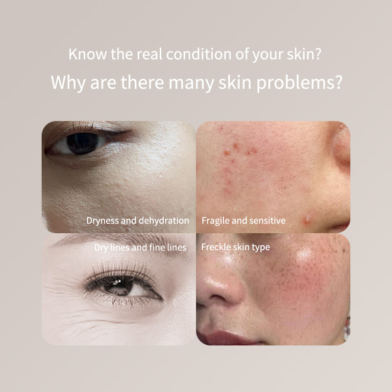 Skincare Only You - ポータブルスキンテスターペン - 顔と体専用、正確な水分/油分レベルチェッカー、LCDディスプレイ、ホームスキンケアデバイス、USBプラグ
